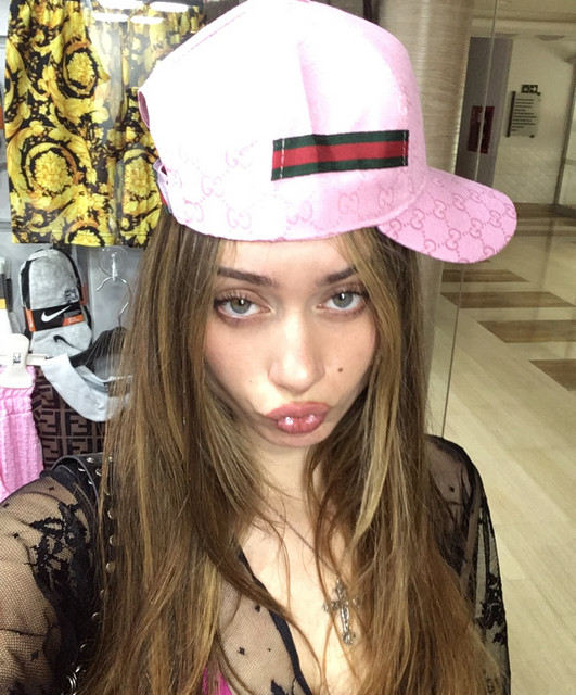 Kyla